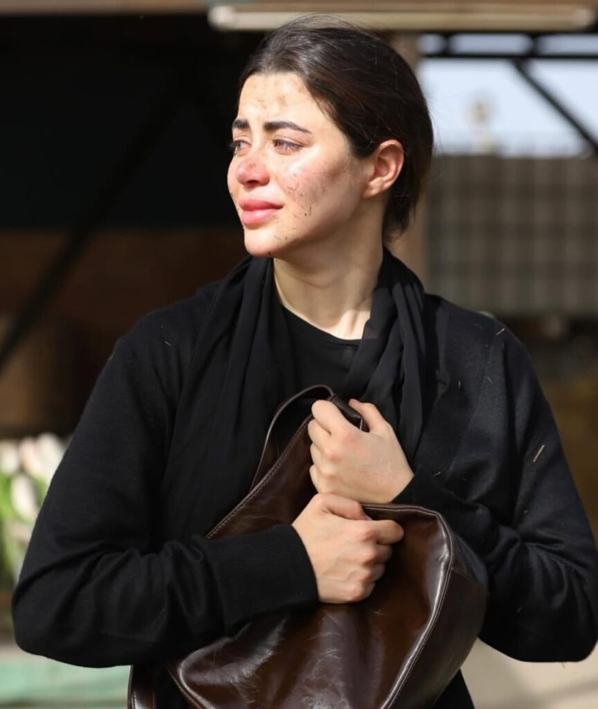 يارا السكري في مسلسل علي كلاي